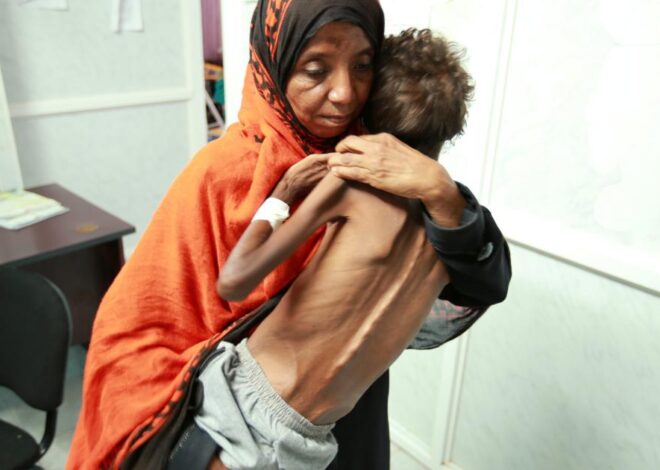 Yemen’s Humanitarian Nightmare